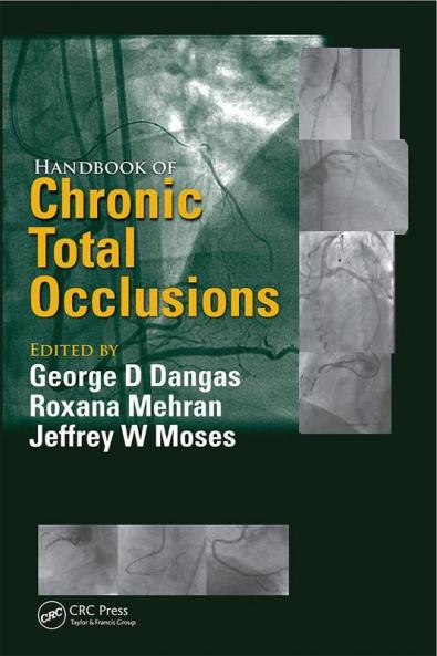 Handbook of Chronic Total Occlusions