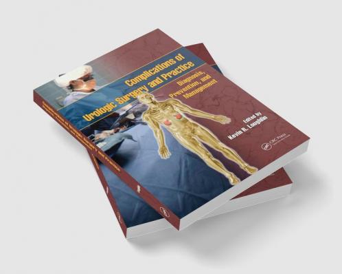 Complications of Urologic Surgery and Practice