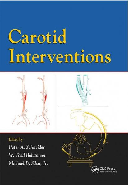 Carotid Interventions
