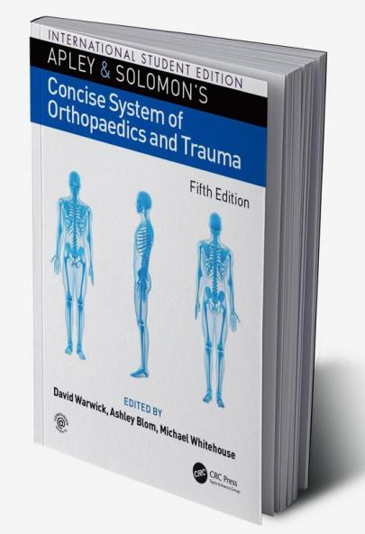 Apley and Solomon’s Concise System of Orthopaedics and Trauma