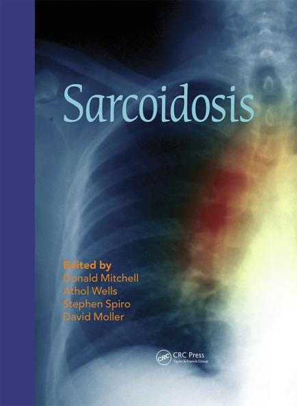 Sarcoidosis