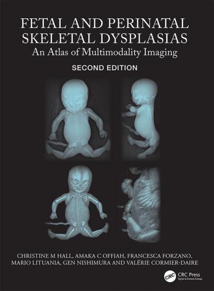Fetal and Perinatal Skeletal Dysplasias
