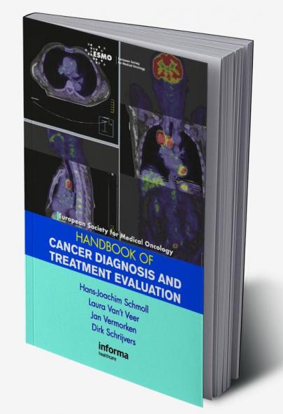 ESMO Handbook of Cancer Diagnosis and Treatment Evaluation