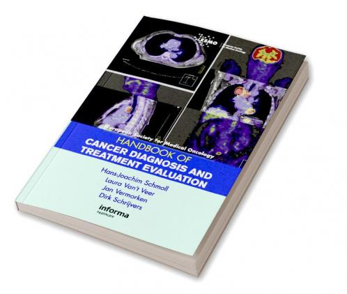 ESMO Handbook of Cancer Diagnosis and Treatment Evaluation