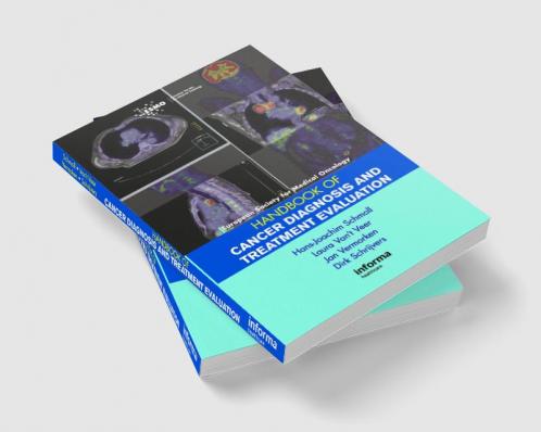 ESMO Handbook of Cancer Diagnosis and Treatment Evaluation