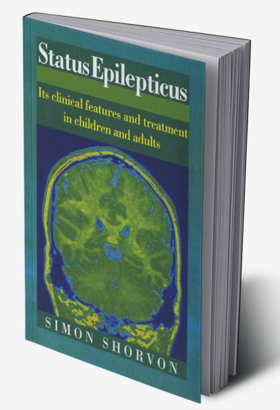 Status Epilepticus