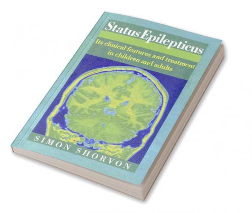 Status Epilepticus
