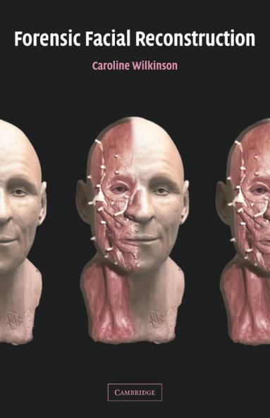 Forensic Facial Reconstruction