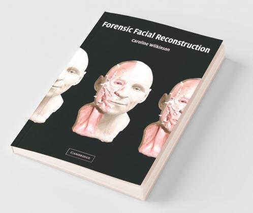 Forensic Facial Reconstruction