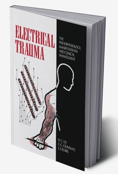 Electrical Trauma
