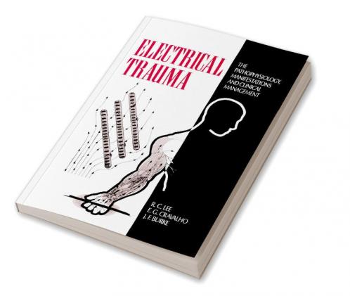 Electrical Trauma