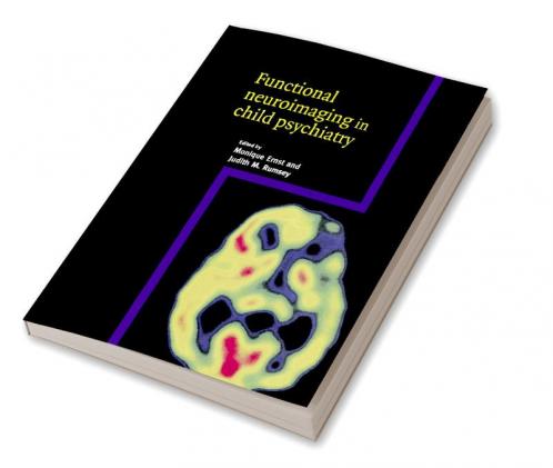 Functional Neuroimaging in Child Psychiatry