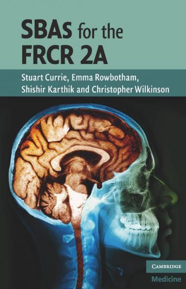SBAs for the FRCR 2A
