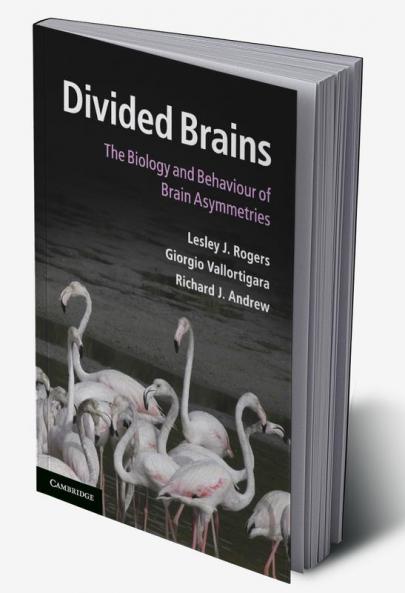 Divided Brains