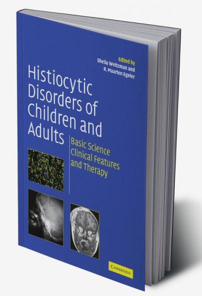 Histiocytic Disorders of Children and Adults