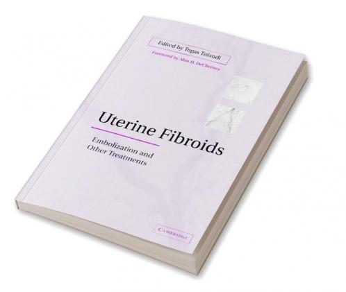 Uterine Fibroids