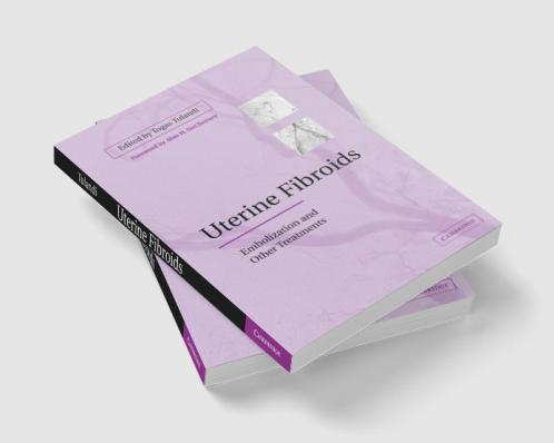 Uterine Fibroids