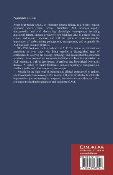 Acute Liver Failure