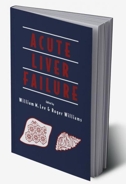 Acute Liver Failure