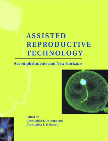 Assisted Reproductive Technology