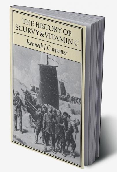 The History of Scurvy and Vitamin C
