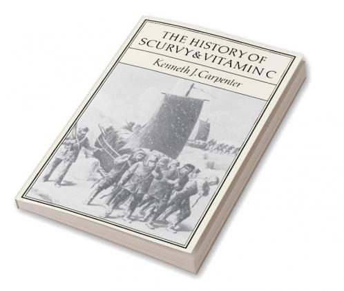 The History of Scurvy and Vitamin C