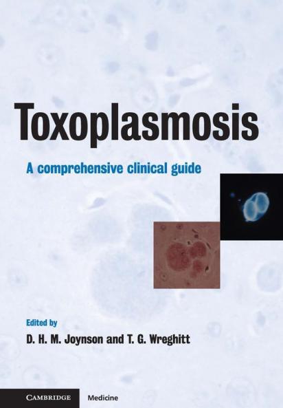 Toxoplasmosis