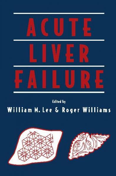 Acute Liver Failure