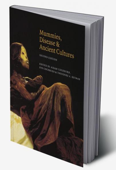 Mummies Disease and Ancient Cultures