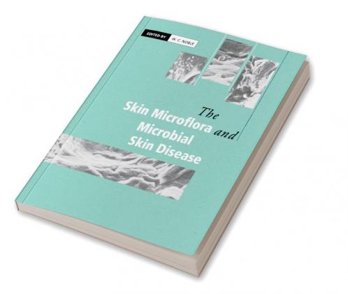 The Skin Microflora and Microbial Skin Disease