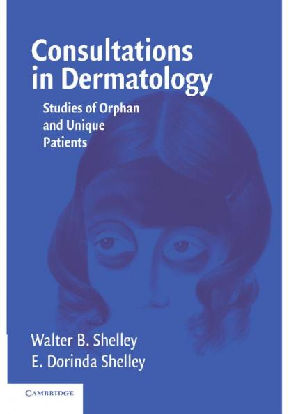 Consultations in Dermatology