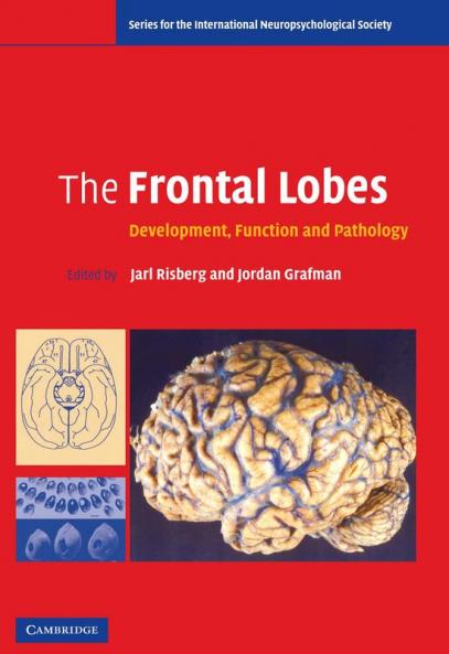 The Frontal Lobes