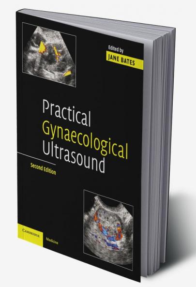 Practical Gynaecological Ultrasound