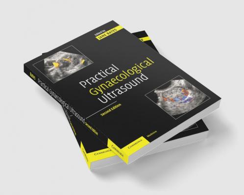 Practical Gynaecological Ultrasound