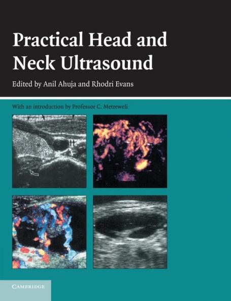 Practical Head & Neck Ultrasound