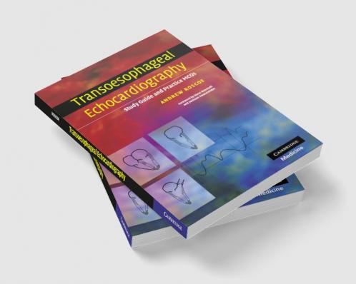 Transoesophageal Echocardiography