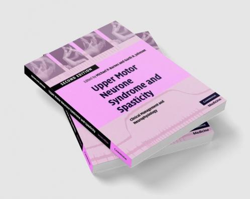 Upper Motor Neurone Syndrome and Spasticity