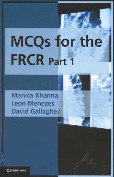 MCQs for the FRCR Part 1