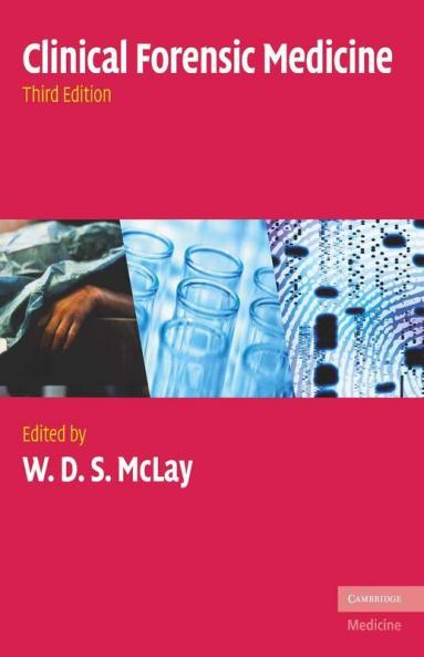 Clinical Forensic Medicine