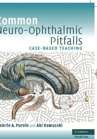 Common Neuro-Ophthalmic Pitfalls