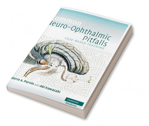 Common Neuro-Ophthalmic Pitfalls