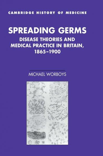 Spreading Germs