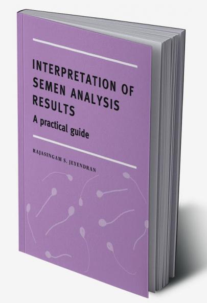 Interpretation of Semen Analysis Results