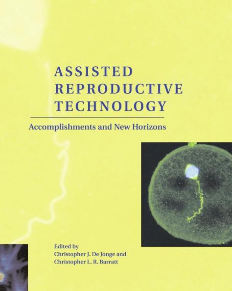 Assisted Reproductive Technology