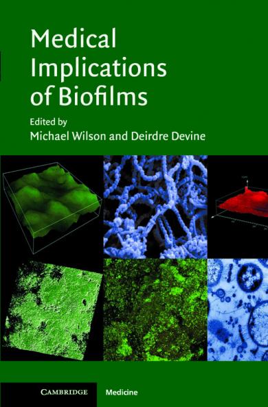 Medical Implications of Biofilms