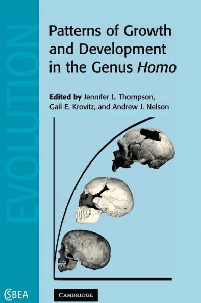 Patterns of Growth and Development in the Genus Homo