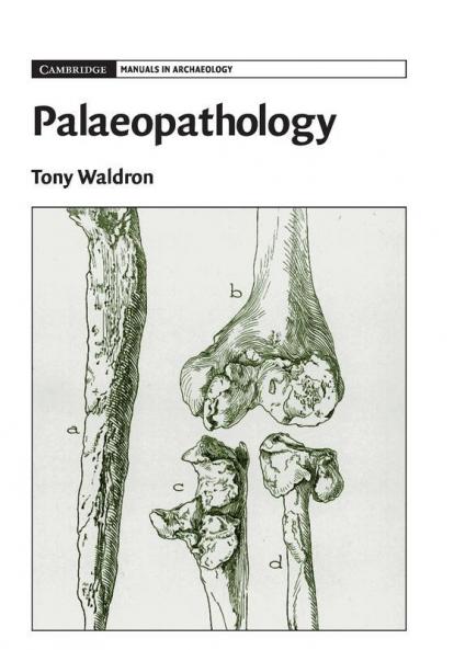 Palaeopathology