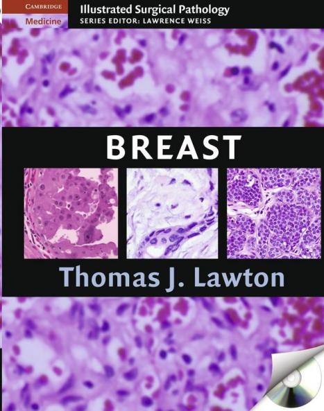 Illustrated Surgical Pathology of the Breast