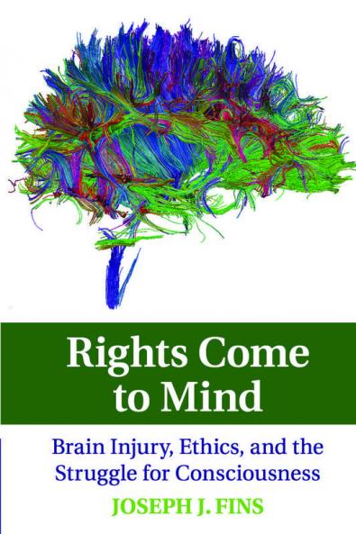 Rights Come to Mind