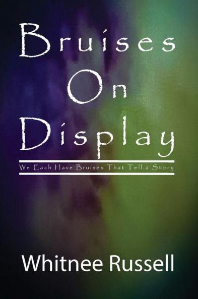 Bruises On Display: We Each Have Bruises That Tell a Story